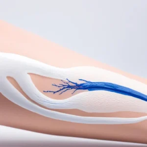 KZ.MAST VENEN  ESCINA  50g