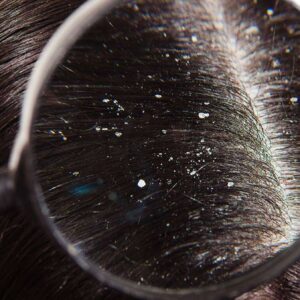 KZ.LOSION PROTIV PERUTI U KOSI  SEMIPER  100ml